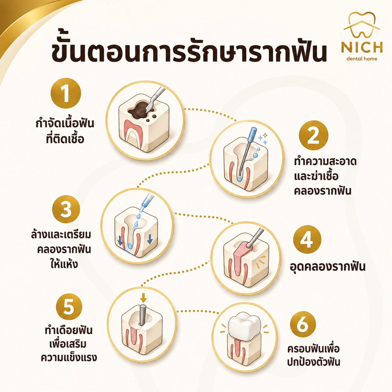บริการรักษารากฟัน